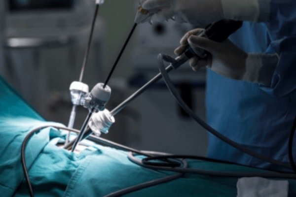 Laparoscopic Surgeon in Chennai - Dr. S. Srivatsan Gurumurthy