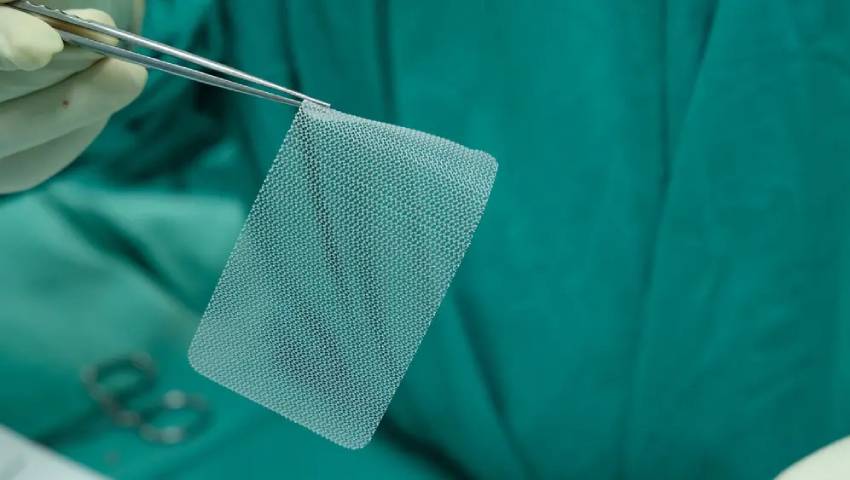 Understanding Hernia Mesh Benefits, Types, and Considerations