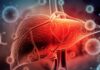 Understanding Chronic Hepatitis: Symptoms, Causes, and Treatment - Dr. Srivatsan Gurumurthy