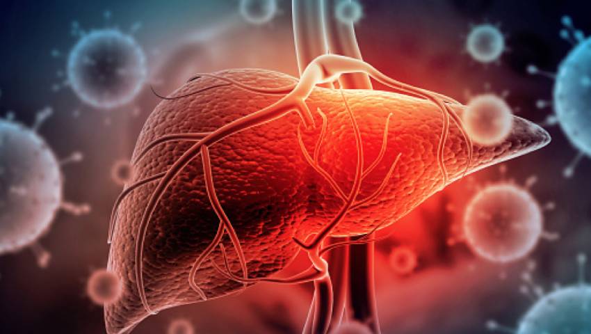 Understanding Chronic Hepatitis: Symptoms, Causes, and Treatment - Dr. Srivatsan Gurumurthy