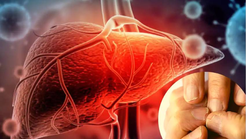 Acute and Chronic Liver Damage - Dr. Srivatsan Gurumurthy